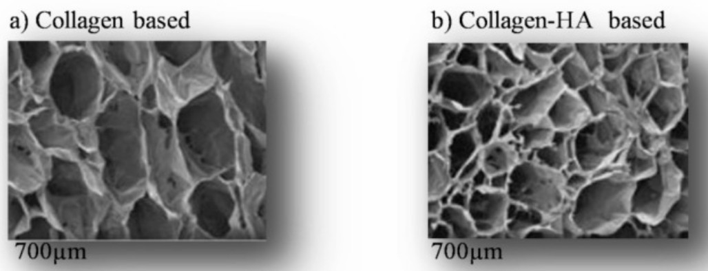 Scanning Electron Microscopy micrographs of freeze-dried scaffolds of collagen-based